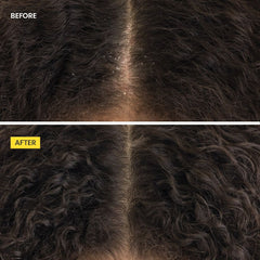 Crown Tonic Scalp-Balancing Jumbo Set